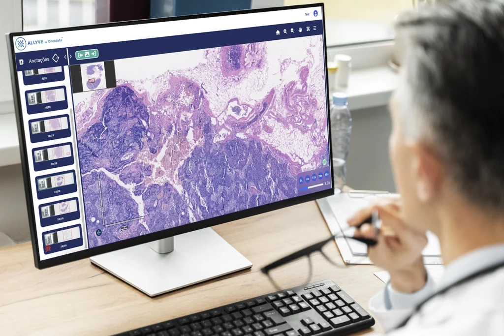 Priorização de casos com inteligência artificial02