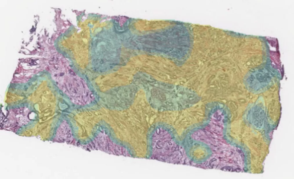 Priorização de casos com inteligência artificial